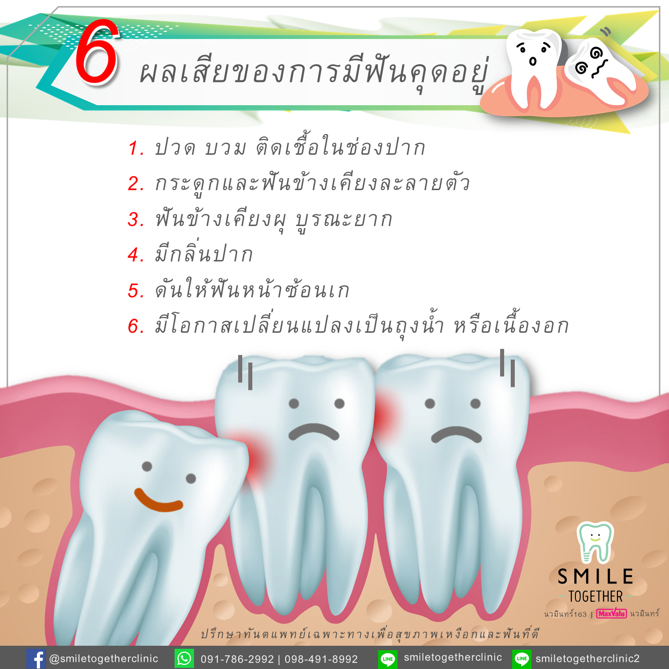 ถอนฟันฝ่าฟันคุด - Smile Together Clinic ถอนฟันฝ่าฟันคุด - Smile Together Clinic